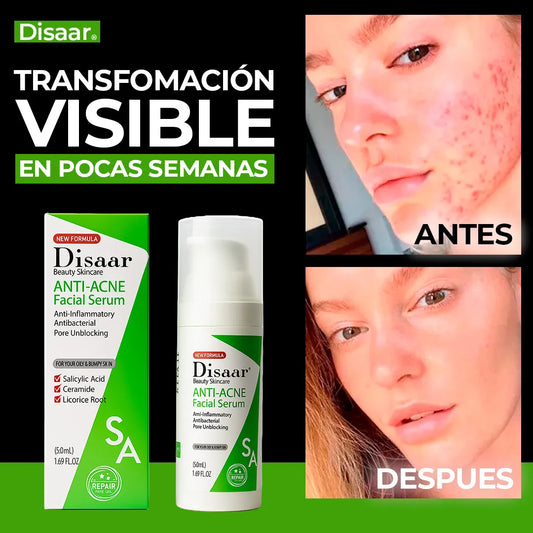 SÚPER SERUM ANTIACNÉ - DISAAR 🧼 LIMPIA PROFUNDAMENTE LOS POROS
