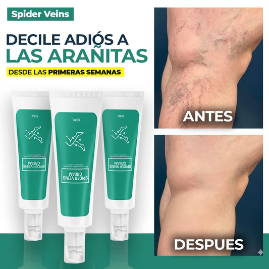 Crema Spider Veins - Relaja y disminuye las venas agrandadas
