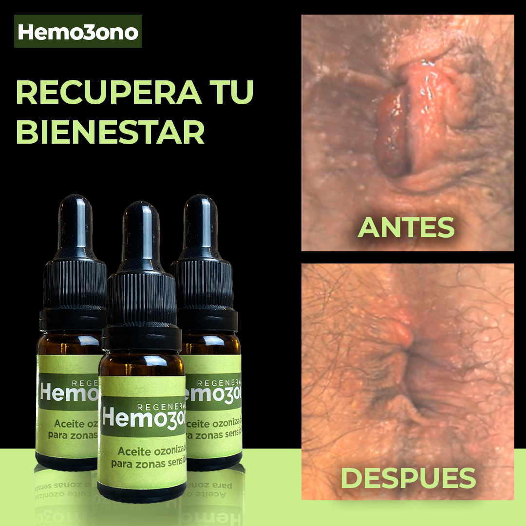 Aceite de Girasol Ozonizado para Zonas Sensibles - Hemozono