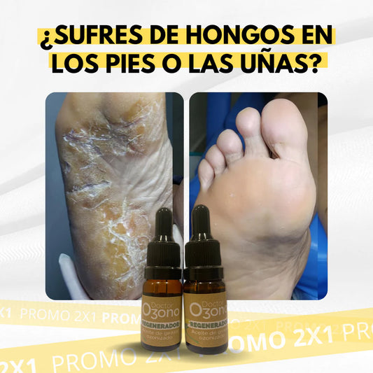 PROMO 2X1 = 175Mil - Aceite de Girasol Ozonizado Doctor Azono - Tratamiento Antifúngico